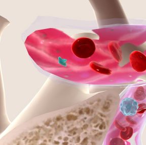 Soluções para Osteopenia: Endocrinologia de Panambi